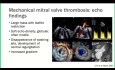 Evaluación ecocardiográfica de válvulas mitrales protésicas