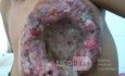Hongos en el tumor del seno izquierdo