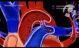 Arterias - tetralogía de Fallot