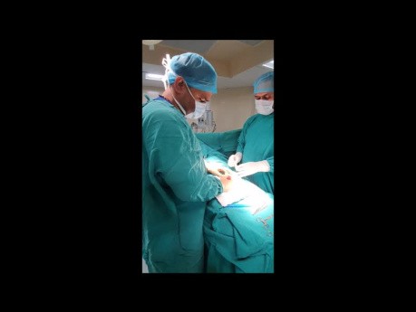 Tratamiento del carcinoma del pene - Amputación parcial del pene con reconstrucción uretral