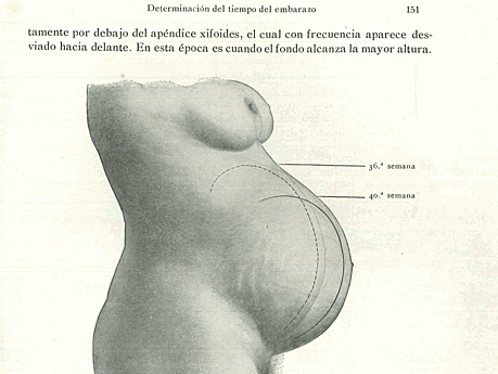 Bumm Obstetricia