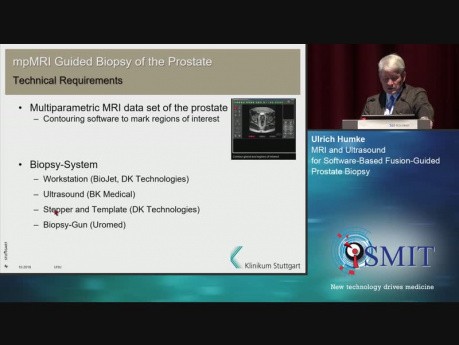 IRM y ultrasonido para biopsia de próstata guiada basada en software - SMIT 2019