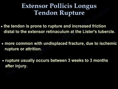 Ruptura del músculo extensor largo del pulgar