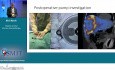 Hepatic Artery Infusion Pump Chemotherapy