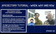 Tutorial de apicectomía: cuándo, por qué y cómo realizar la cirugía apical - PDP148