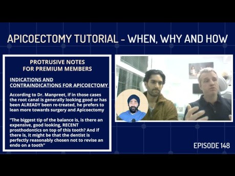 Tutorial de apicectomía: cuándo, por qué y cómo realizar la cirugía apical - PDP148