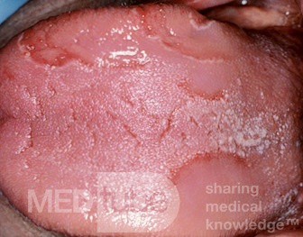 Lengua geográfica