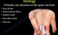 Dolor lumbar - causas y métodos de tratamiento