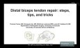 Procedimiento ortopédico - Reparación del tendón distal del bíceps