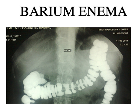 Radiología intervencionista