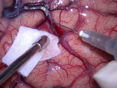 Cardiology
