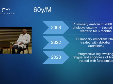 HPTEC - Hipertensión pulmonar tromboembólica crónica: reflexiones sobre el diagnóstico y el tratamiento
