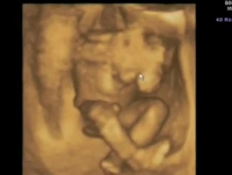Imagen de ultrasonido del movimiento del bebé