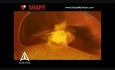 SHAPE - Anuncio de servicio público de ataque cardíaco - Animación médica en 3D