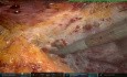 Reparación robótica TAPP M3 de hernia umbilical 