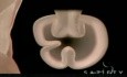 Gastroplastia Transoral (TOGA)