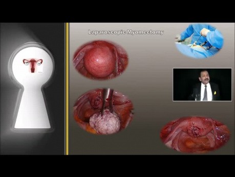 Transmisión en vivo de DR RK Mishra - Introducción a la Cirugía de Mínimo Acceso