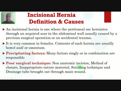 Hernias abdominales