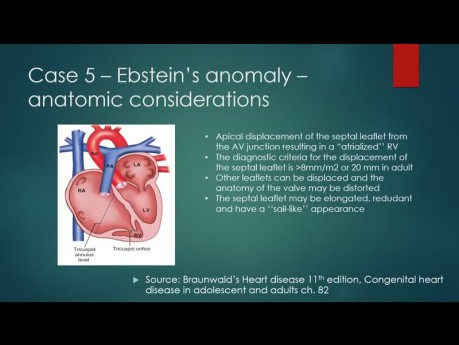 Aprendizaje basado en casos sobre cardiopatías congénitas y derivaciones