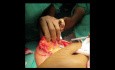Cirugía de conservación de mama