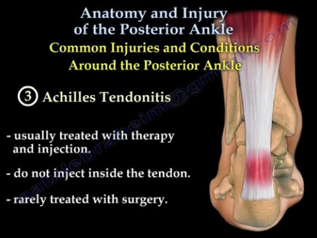 Tobillo posterior - anatomía y lesiones