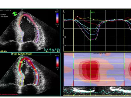 Características ecocardiográficas de las enfermedades sistémicas: una discusión basada en casos